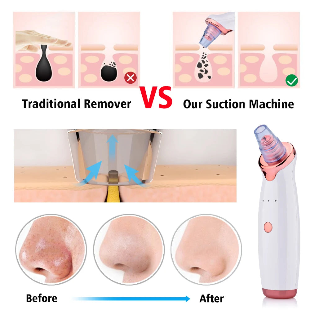 Electric Facial Blackhead Remover Vacuum Pore Cleaner Acne Cleanser Black Spots Removal Face Nose Deep Cleaning tools