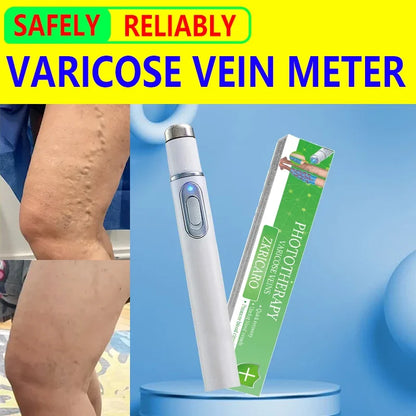 Powerful laser therapy improves moderate varicose veins, relieves pain and improves circulation in men and women